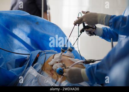 Hände laparoskopischer Operationsarztpraxen. Hochwertige Fotos Stockfoto