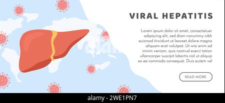 Konzept der Hepatitis A, B, C, D, Zirrhose, der Welttag der Hepatitis. Web Horizontal Banner Vorlage mit Weltkarte und gesunder menschlicher Leber angegriffen von vir Stock Vektor