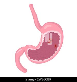 Illustration der menschlichen Anatomie für atlas, Lehrbuch oder Lernmaterial. Gesunder Magen im Cartoon-Stil. Stock Vektor