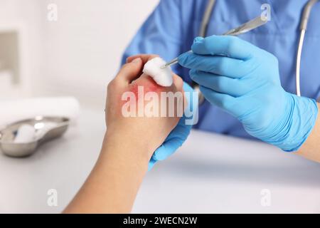 Arzt, der die verbrannte Hand des Patienten am Tisch behandelt, Nahaufnahme Stockfoto