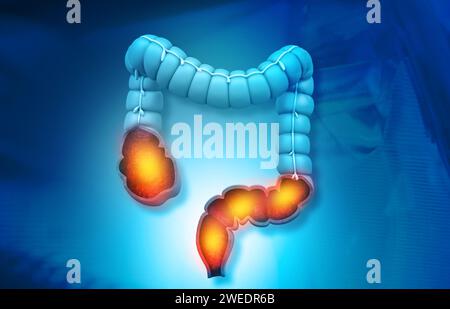 Dickdarmanatomiemodell vor medizinischem Hintergrund. 3D-Abbildung Stockfoto