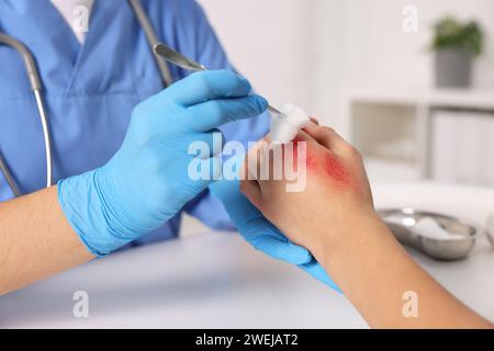 Arzt, der die verbrannte Hand des Patienten am Tisch behandelt, Nahaufnahme Stockfoto