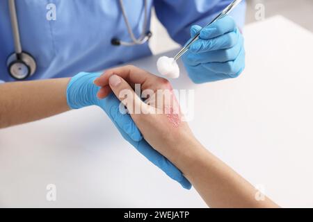 Arzt, der die verbrannte Hand des Patienten am Tisch behandelt, Nahaufnahme Stockfoto