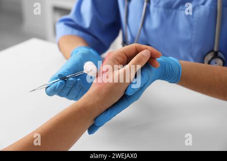 Arzt, der die verbrannte Hand des Patienten am Tisch behandelt, Nahaufnahme Stockfoto