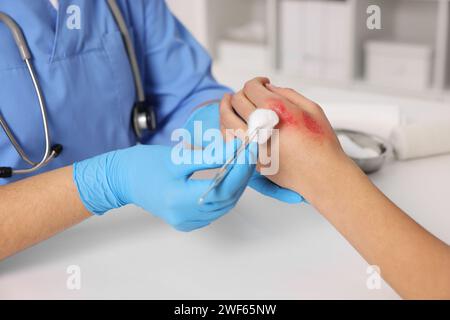 Arzt, der die verbrannte Hand des Patienten am Tisch behandelt, Nahaufnahme Stockfoto