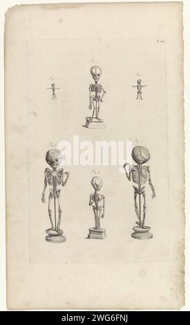 Anatomische Untersuchungen der Skelette von Fetussen, Pieter van Gunst, nach Gerard de Lairesse, 1685 Print Anatomische Untersuchungen der Skelette von Fetussen in den verschiedenen Wachstumsstadien. T. 100 oben rechts. Amsterdamer Papierätzung / Gravur (menschliches) Skelett (+ junger Mann (Mensch)). Der Fetus. (Menschliches) Skelett (+ Vorderansicht) Stockfoto