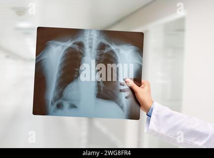 Die Hand des Mannes hält eine Lungenradiographie im Krankenhaus Stockfoto