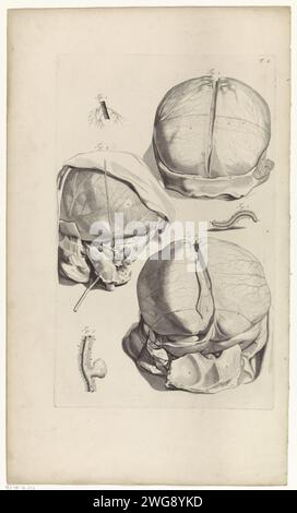 Anatomische Untersuchung des Schädelrückens, Pieter van Gunst, nach Gerard de Lairesse, 1685 drucken drei anatomische Darstellungen eines Schädels. Oben rechts mit T 6 nummeriert. Amsterdam Papiergravur (menschlicher) Schädel (+ Rückansicht) Stockfoto