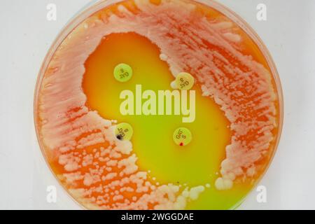 Kolonien von Bakterien und Mikroorganismen auf der Oberfläche von Agar und Wind während der mikrobiologischen Analyse in einem wissenschaftlichen Labor Stockfoto