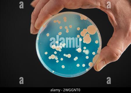 Kolonien von Bakterien und Mikroorganismen auf der Oberfläche von Agar und Wind während der mikrobiologischen Analyse in einem wissenschaftlichen Labor Stockfoto