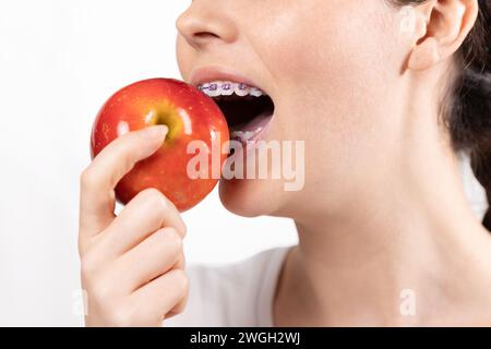 Nahaufnahme einer jungen kaukasischen lächelnden Frau mit Zahnspangen, die roten Apfel beißen. Weißer Hintergrund. Das Konzept der kieferorthopädischen Behandlung und Korrektur des Meluks Stockfoto