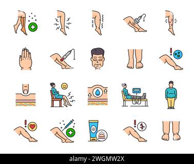 Ödeme Linien Symbole, Krankheit der Bein Knöchel und Fuß Schwellung, Symptome und Behandlung Vektor Symbole. Ödem lymphatische Gefäßgefäße oder Adipositas Krankheit der Beine und Füße, Diagnose und medizinische Versorgung lineare Symbole Stock Vektor