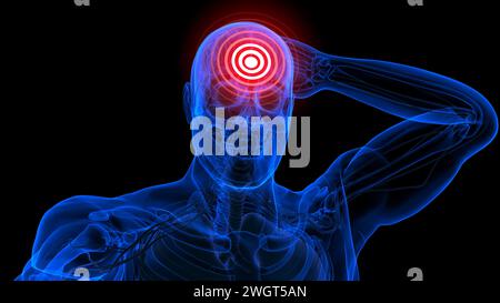 Gefühlskopfschmerzanatomie für medizinische Konzeptbildgebung Stockfoto