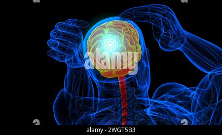 Gefühlskopfschmerzanatomie für medizinische Konzeptbildgebung Stockfoto
