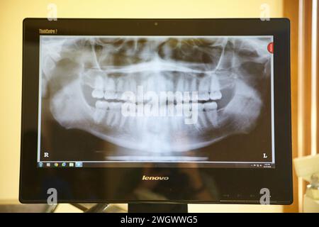 Panorama-Zahnröntgenaufnahme am Monitor in der Klinik Stockfoto