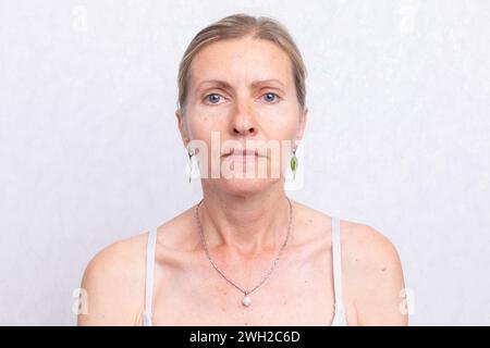 Gesicht mit Alterserscheinungen einer älteren Frau. Alternde Haut. Stockfoto