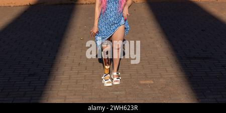 Schöne junge Frau Beinamputierte in einem Kleid, die am sonnigen Tag im Park spaziert. Das Leben geht weiter, egal was passiert. Stockfoto