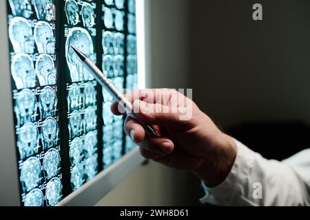 Hand eines nicht erkennbaren männlichen Radiologen mit Stift, der auf Hirnscan an der Wand zeigt in der Arztpraxis moderner Kliniken während der Diskussion Stockfoto