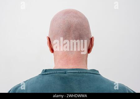 Rückansicht eines Mannes mit rasiertem Kopf. Glatze Stockfoto