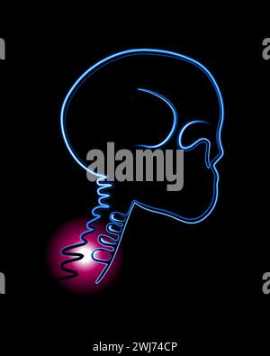 Vektorisolierte Darstellung des Halswirbelschmerzes. Konturzeichnung der Halsregion mit Wirbelschmerzenlokalisation. Stock Vektor