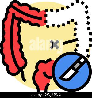 Darmresektion Chirurgie Arzt Farbe Symbol Vektor Illustration Stock Vektor