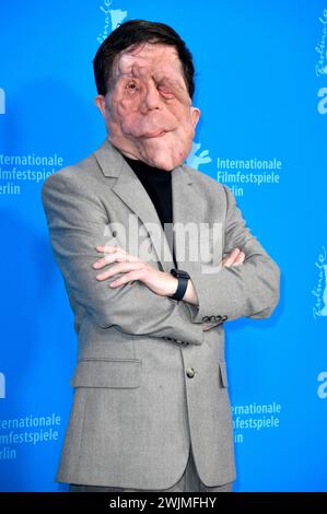 Adam Pearson beim Photocall zum Kinofilm A Different man auf der