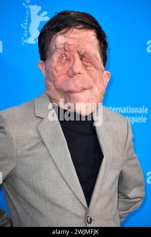 Adam Pearson beim Photocall zum Kinofilm A Different man auf der