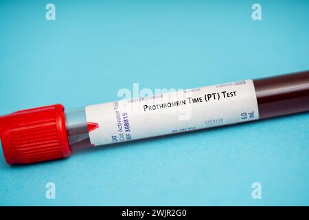 Prothrombinzeit (pt)-Test Stockfoto