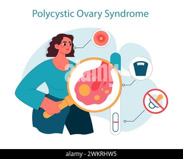 Polyzystisches Ovarialsyndrom. Frau, die gynäkologische Krankheit untersucht, Vergrößerung eines entzündeten Ovars, Indikatoren für PCOS-Gesundheitszustand. Reproduktives Gesundheitsbewusstsein. Illustration des flachen Vektors Stock Vektor