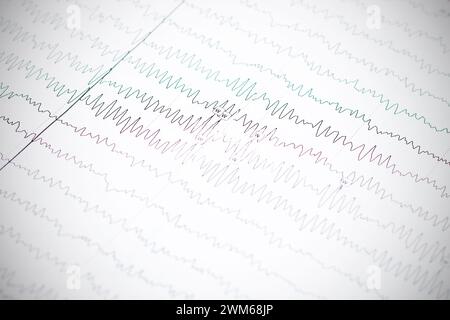 Nahaufnahme-Eklektroenzephalogramm auf Papier, Epilepsiediagnostik Stockfoto