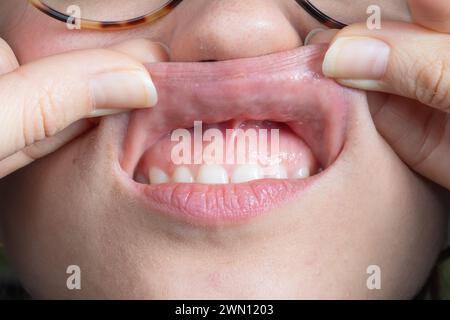 Nahaufnahme des offenen Mundes einer Person mit gesunden Zähnen und Zahnfleisch und der Textur der inneren Lippe Stockfoto