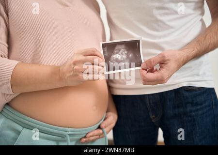 Ehemann und Ehefrau umarmen das Ultraschallbild des Babys Stockfoto