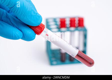 Teströhrchen mit Blutproben Stockfoto