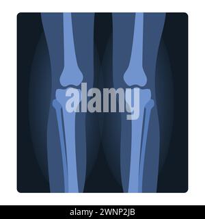 Röntgenaufnahme menschlicher Knie. Medizinischer Verletzungstest, Körperradiographie Karikaturvektor-Illustration Stock Vektor