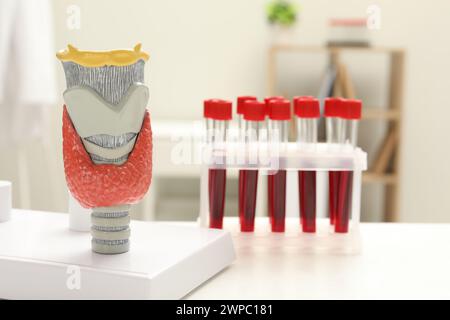 Endokrinologie. Modell der Schilddrüse und Blutproben in Reagenzgläsern auf weißem Tisch in der Klinik Stockfoto