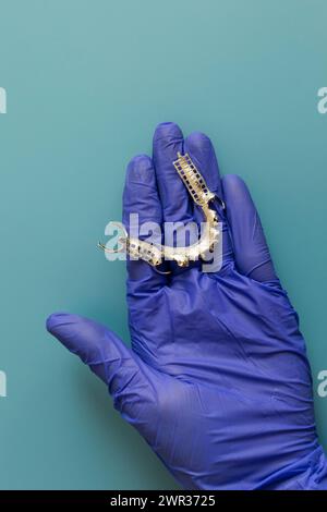 Untere Teilprothese mit Metallrahmen, Zahnplatte aus Kobalt-Chrom, Brücke mit 3D-Drucker in der Hand des Arztes. Blauer Hintergrund. Modell Mit Flacher Anordnung. Kopieren Stockfoto