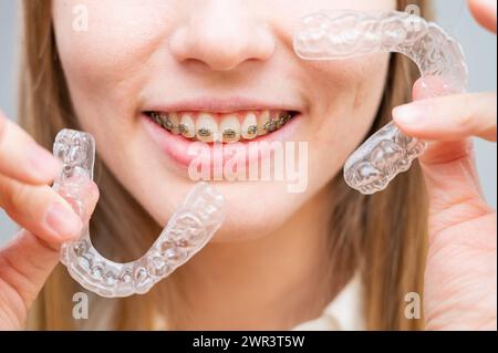 Frau mit Zahnspangen und abnehmbaren transparenten Alignern. Stockfoto