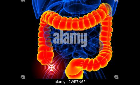 anhang Schmerzanatomie zur medizinischen Konzeptdarstellung 3D Stockfoto
