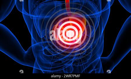 Magenschmerzeranatomie zur medizinischen Konzeptdarstellung Stockfoto