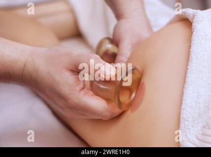 Der Masseur massiert mit Gläsern Cellulite auf dem Gesäß und den Oberschenkeln des Patienten. Behandlung des Übergewichts. Stockfoto