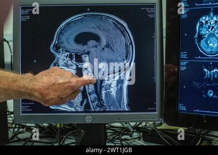 Neurochirurg ponting in Richtung Computer, Analyse MRT-Scan, Diagnose Gehirn. Gehirnchirurgie Health Clinic Lab. Stockfoto