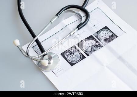 Bild des Gehirns auf den Ergebnissen der Studie Nahaufnahme Stockfoto