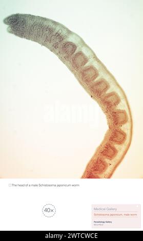 Schistosoma japonicum ist ein Parasit, der menschliche Schistosomiasis verursacht und vor allem in Asien vorkommt. Stockfoto