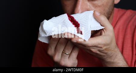 Mann, der ein blutiges Taschentuch in der Hand hält, Nahaufnahme Stockfoto