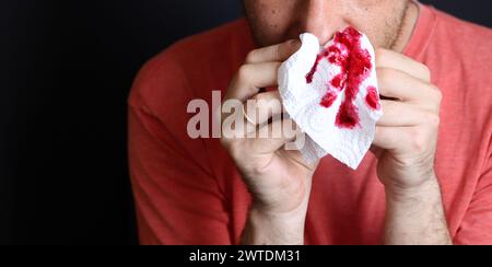 Mann, der ein blutiges Taschentuch in der Hand hält, Nahaufnahme Stockfoto