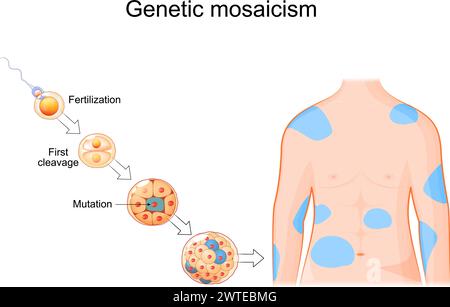 Genetischer Mosaik. Somatische Mutation. DNA-Replikationsfehler. Zellentwicklung von der Befruchtung zur Morula mit Mutation. Menschlicher Körper mit Betroffenen sind Stock Vektor