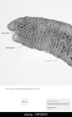 Schistosoma japonicum ist ein Parasit, der menschliche Schistosomiasis verursacht und vor allem in Asien vorkommt. Stockfoto