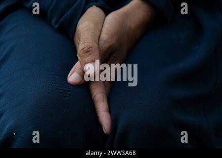 Die arme Frau legt ihre Hände zwischen die Knie Stockfoto