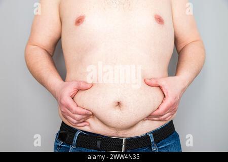 Die Hände eines nicht erkennbaren Mannes greifen sein übergewichtiges Bauchfett. Stockfoto