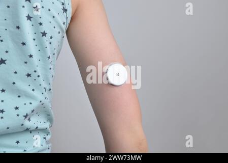 Kinderhand mit weißem Sensor zur kontinuierlichen Glukoseüberwachung. Konzept der Gesundheit, Diabetesmanagement, Medizintechnik und Monitoring-Lösungen Stockfoto